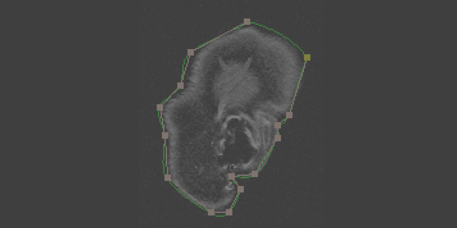Image of medical image with control points and a green contour connecting the points, outlining the object in the image